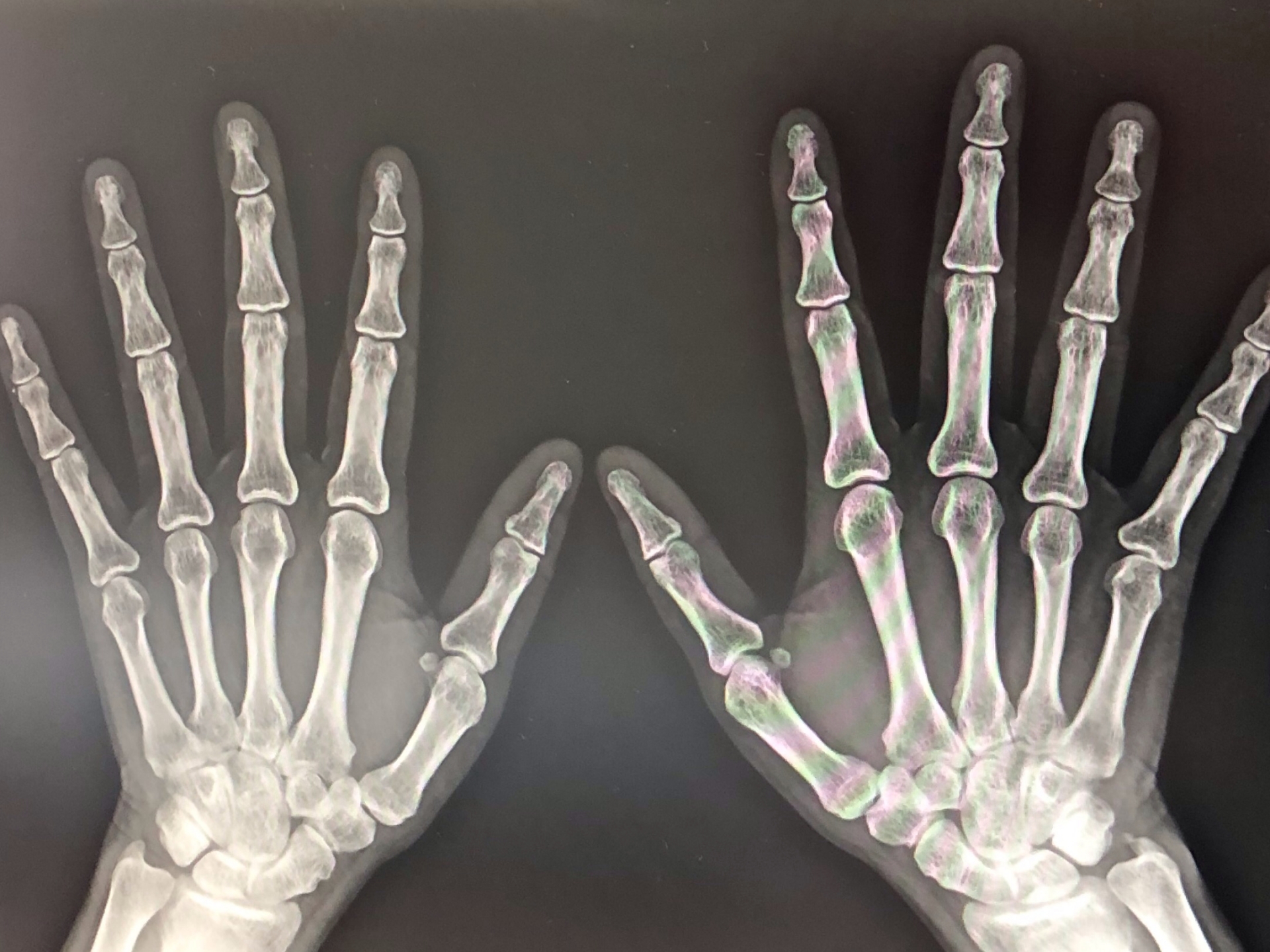 親指の使い方〜ピアノを弾きやすい手を作る 木山音楽教室